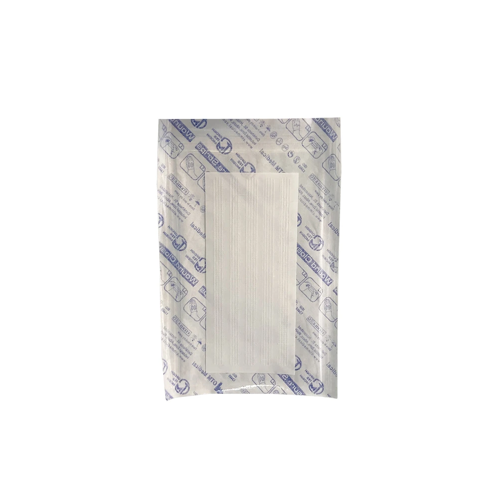 g-wound-clousure-strips-6-in-100-mm