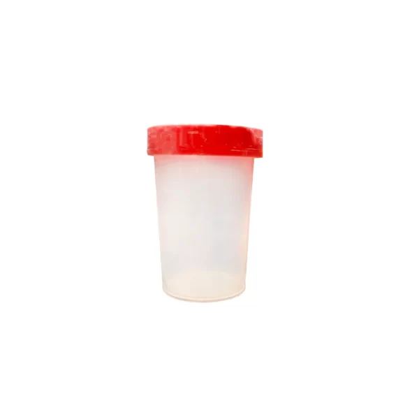 qc-lab-disposable-urine-culture-60-ml